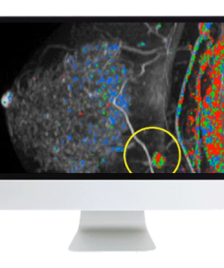 Breast Imaging Pearls and Pitfalls: Traditional and Novel Imaging Approaches 2020 (CME VIDEOS)