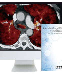 Practical Dual-Energy CT Throughout the Body 2021 (CME VIDEOS)