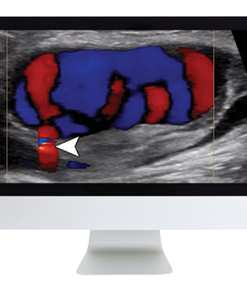 Clinical Ultrasound Review 2017 (ARRS VIDEOS) (CME VIDEOS)