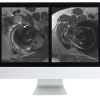 ARRS Controversies in Hip and Pelvis Imaging 2016 (CME VIDEOS)