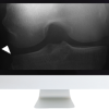 Musculoskeletal Imaging for the Practicing Radiologist 2018 (ARRS VIDEOS) (CME VIDEOS)