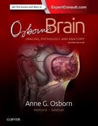 Osborn’s Brain, 2nd Edition