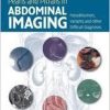 Pearls and Pitfalls in Abdominal Imaging: Pseudotumors, Variants and Other Difficult Diagnoses (Cambridge Medicine (Hardcover))