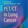 PET/CT in Lung Cancer (Clinicians’ Guides to Radionuclide Hybrid Imaging) 1st