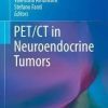 pet/ct in neuroendocrine tumors (clinicians’ guides to radionuclide hybrid imaging)