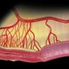 MRIOnline Imaging Mastery Series Crohn’s Disease 2021 (CME VIDEOS)
