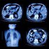 UCSF Abdominal and Thoracic Imaging 2022 (CME VIDEOS)