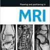 Planning and Positioning in MRI, 1e