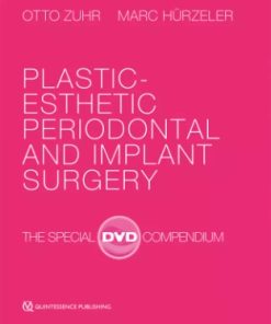 Plastic-Esthetic Periodontal and Implant Surgery: The Special DVD Compendium