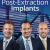 Post-Extraction Implants (Video course)