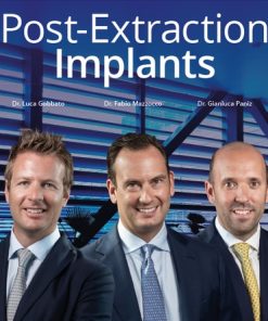 Post-Extraction Implants (Video course)