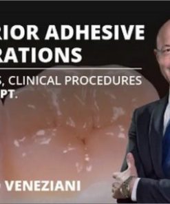 Posterior Adhesive Restorations: Indications, Clinical Procedures and mDPT Techniques