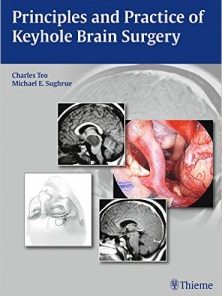 Principles and Practice of Keyhole Brain Surgery