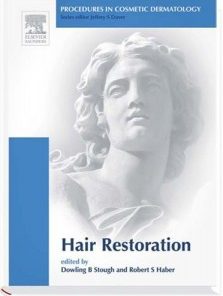Procedures in Cosmetic Dermatology Series: Hair Transplantation