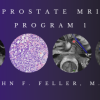 Prostate MRI (Program 1) – John F. Feller, M.D. (CMEScience) (CME Videos)
