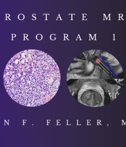 Prostate MRI (Program 1) – John F. Feller, M.D. (CMEScience) (CME Videos)