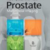 Prostate – Multimodal Imaging
