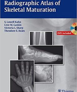 Radiographic Atlas of Skeletal Maturation