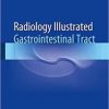 Radiology Illustrated Gastrointestinal Tract