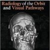 Radiology of the Orbit and Visual Pathways (Expert Consult Title: Online + Print)