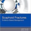 Scaphoid Fractures: Evidence-Based Management