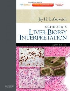 Scheuer’s Liver Biopsy Interpretation, 8e