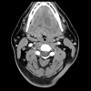 MRIOnline Imaging Mastery Series: Pathology of the Oral Cavity and Oropharynx 2020 (CME VIDEOS)