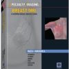 Specialty Imaging: Breast MRI: A Comprehensive Imaging Guide (Published by Amirsys®)