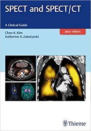 SPECT and SPECT/CT: A Clinical Guide 1st Edition