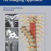 Spinal Trauma – An Imaging Approach