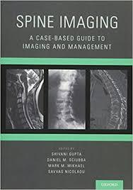Spine Imaging: A Case-Based Guide to Imaging and Management 1st Edition