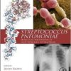 Streptococcus Pneumoniae: Molecular Mechanisms of Host-Pathogen Interactions