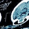Stroke and Other Common Neurological Conditions 2019 (CME VIDEOS)