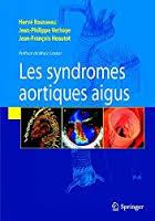 Syndromes aortiques aigus (French Edition)