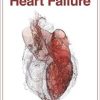 The 4 Stages of Heart Failure (PDF)
