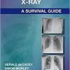 The Chest X-Ray: A Survival Guide, 1e