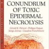 The Conundrum of Toxic Epidermal Necrolysis