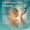 The ESC Textbook of Cardiovascular Imaging (European Society of Cardiology Publications) 2nd Edition