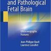 The Normal and Pathological Fetal Brain: Ultrasonographic Features