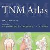 TNM Atlas, 6e