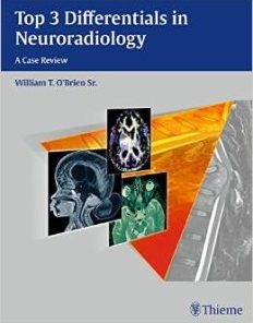 Top 3 Differentials in Neuroradiology: A Case Review (PDF)