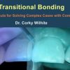 Transitional Bonding – The Formula for Solving Complex Cases with Components