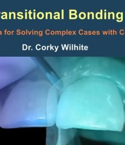 Transitional Bonding – The Formula for Solving Complex Cases with Components