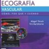 Ultrasonido vascular. Cómo, por qué y cuándo: Cómo, por qué y cuándo (Spanish Edition)