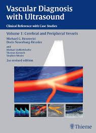 Vascular Diagnosis with Ultrasound: Clinical Reference with Case Studies: 1