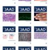 Journal of the American Academy of Dermatology 2021 Full Archives (True PDF)
