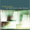Fractures of the Foot and Ankle (PDF)