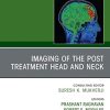 Imaging of the Post Treatment Head and Neck, An Issue of Neuroimaging Clinics of North America, E-Book (Clinics Collections) (PDF Book)