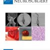 Journal of Neurosurgery 2023 Full Archives (True PDF)