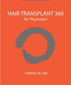 Hair Transplant 360 for Physicians 2 Edition